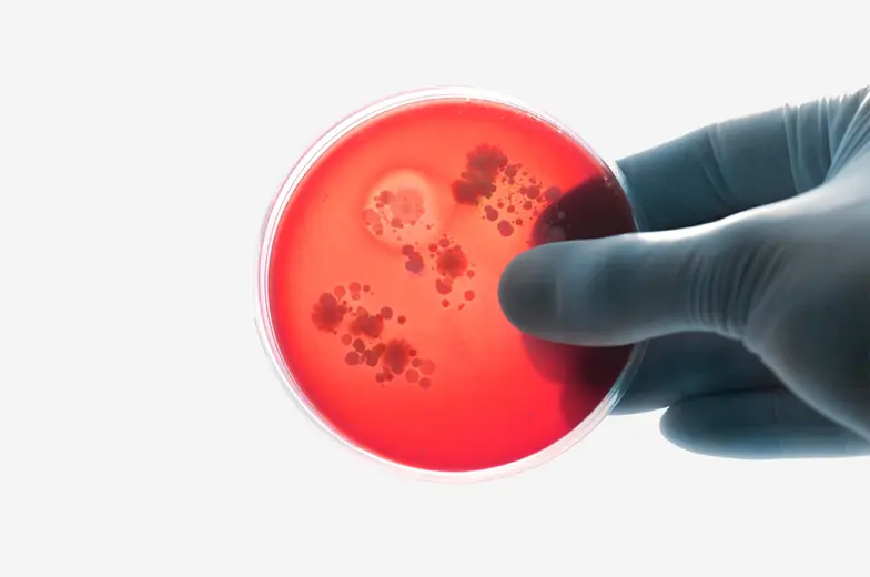 Petrischale mit sichtbaren mikrobiologischen Kulturen zur Kontrolle und Bewertung nach einer Sanierungsmaßnahme.